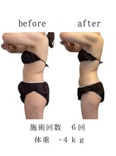 ココロミ(cocoromi)/ハイパーナイフ