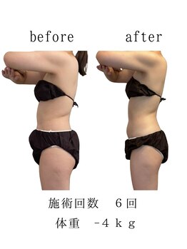 ココロミ(cocoromi)/ハイパーナイフ