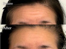 アリス(alice)の雰囲気(【おでこのしわ改善】たるみ・むくみを徹底ケア若見えを叶えます)