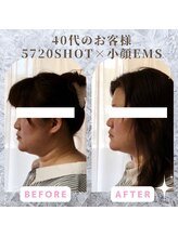 ラ セラフィータ 中目黒/【上級小顔】EMS美容液導入付き