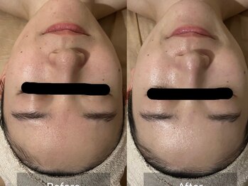 ルナ(Luna)/クリスティーナ(アンストレス)