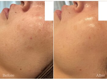 フェイシャルクレア(Cre A.)/光フェイシャル