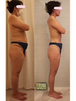 ファニービー 茨木本店/Before→After