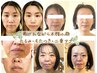 【むくみ・たるみ・二重アゴ】小顔矯正＋ヘッド＆デコルテ70分12,000→7,700