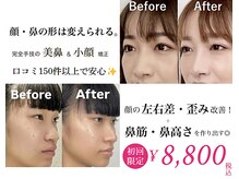 隆鼻矯正専門店 ラプリエイル 千葉店(Raplit aile)