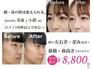 隆鼻矯正専門店 ラプリエイル 千葉店(Raplit aile)