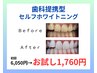 【4回で完了！】歯科提携セルフホワイトニング　8分×2　お試し初回　￥1980
