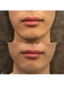 フェリーバ 流山店(FELIVA)/第一印象変わります