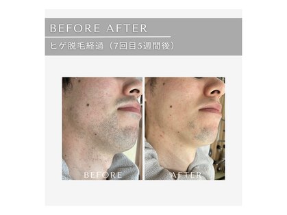 ジール(GIILL)の写真