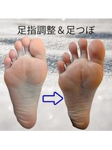 シトロン(CITRON)/足指調整＆足つぼ