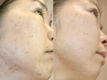 ポモナ 横浜馬車道店(Pomona)の雰囲気（オーナー自信が当店の施術のみでこんなに綺麗に！証拠、根拠あり）