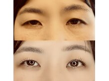 グロウビューティー(grow beauty)/