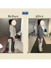 とくしま整体院 康/姿勢の変化