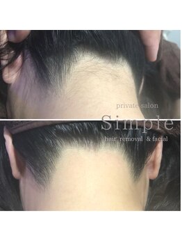 シンプル 中野(Simple)/うなじ整えます