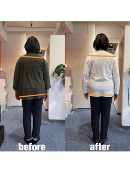 カワル整体 上通り院/【筋力低下による姿勢の崩れ】