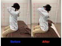 整体院 仁(JIN)/#頭痛#眼精疲労#小頭#小顔矯正