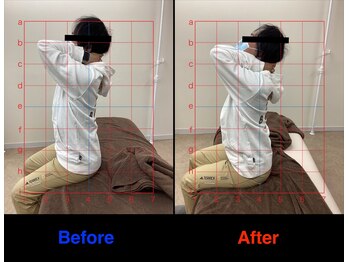 整体院 仁(JIN)/#頭痛#眼精疲労#小頭#小顔矯正