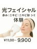 赤み｜ニキビ｜シミ！光フェイシャル体験￥11000→