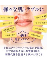 サザンベル 石垣店(SOUTHERN BELLE)/ご要望の多数のハイドラ【復活】