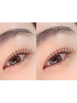 まつげのお悩み解決サロン