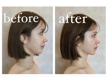 ナルシス(Narcissus)/インディバbefore→after