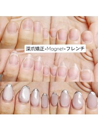 深爪矯正×Magnet×フレンチ