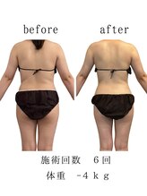 ココロミ(cocoromi)/ハイパーナイフ