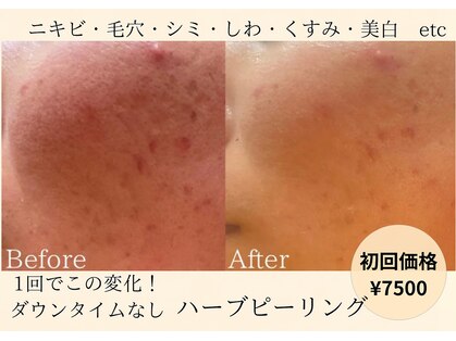 ルアーナ(Luana)の写真