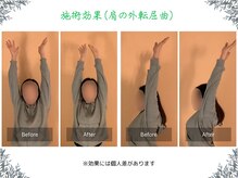 ボディ リセット アンド デザイン(Body Reset & Design)/【施術例】ビフォーアフター