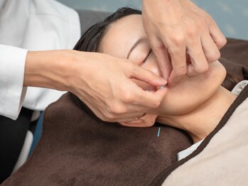 グリーンノア鍼灸院/美容鍼