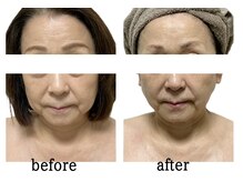 シュクラン(SHUKRAN)の雰囲気(ボディ×フェイシャルコースで1度でも驚きの変化に!)