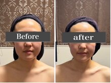 小顔アンドエイジングケア専門店 ビゼ(美sser)/美sser小顔コルギ