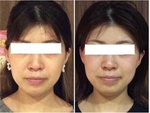 ウェリナ 一宮院/小顔矯正/骨盤矯正/痩身整体