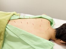 鍼灸治療院養源堂 西小山院/■慢性的なお悩みに寄り添います