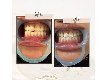 マオ(mao)/☆2回Before→after☆