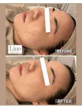 リノ 西宮北口店(Lino)/