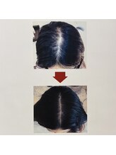 イーズ/リバイタ グランツリー武蔵小杉店/【ケース7】30代女性