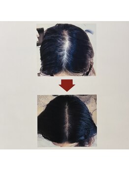 イーズ/リバイタ グランツリー武蔵小杉店/【ケース7】30代女性