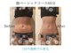 リープル(Leapl)の写真