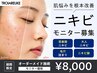 本気の肌改善！ニキビモニター￥22.000→￥8.000