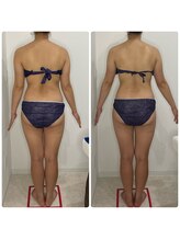 カプリス(CAPRiCE)/リンパドレナージュ