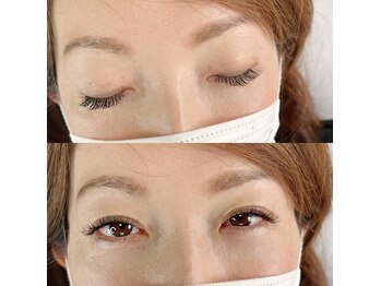 ビューティーリミ/お顔の黄金バランスでご提案