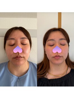 こうぞう整体院/美容鍼×筋膜リリース