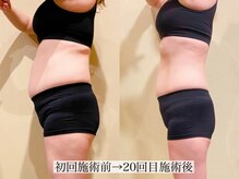 アンジー(Angie)/驚きの大変身