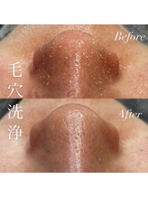 アース コアフュールボーテ 新潟紫竹山店(EARTH coiffure beaute)/毛穴洗浄