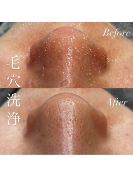 アース コアフュールボーテ 新潟紫竹山店(EARTH coiffure beaute)/毛穴洗浄