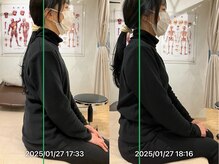 グレフル鍼灸接骨院 整体院 心斎橋/肩こり／首コリ／肩甲骨はがし