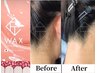 【女性人気NO.1/目指せ見返り美人】　匠道ワックス◆うなじ脱毛　3300円
