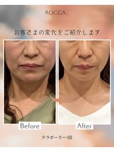 ロッカ(ROCCA..)/テラボーラー