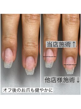 オフ後のお爪も健やかに
